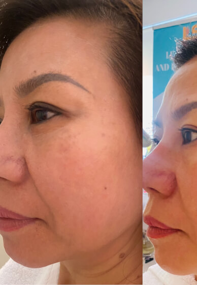 Facial Therapy Course