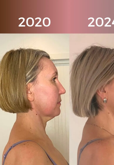 Learn a Face Yoga Ritual: Self-Massage