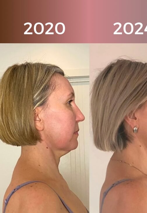 Learn a Face Yoga Ritual: Self-Massage