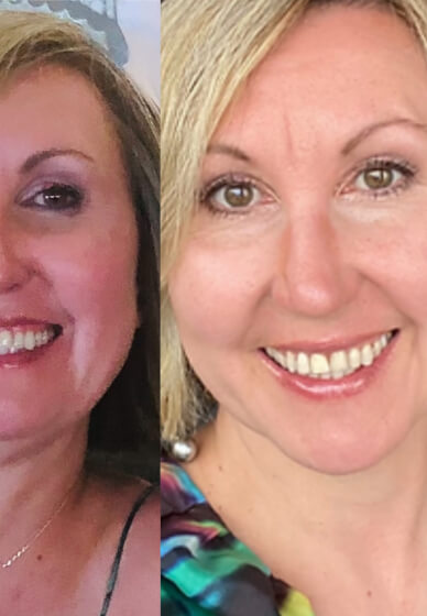 Learn a Face Yoga Ritual: Self-Massage
