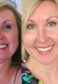 Learn a Face Yoga Ritual: Self-Massage
