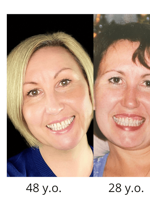 Learn a Face Yoga Ritual: Self-Massage